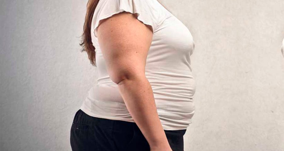 Obesidade: a importância do Endocrinologista